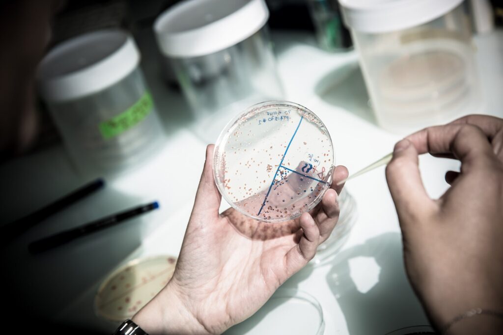 Mains d’une chercheuse tenant une boîte de Petri annotée, avec des cultures bactériennes, dans un laboratoire