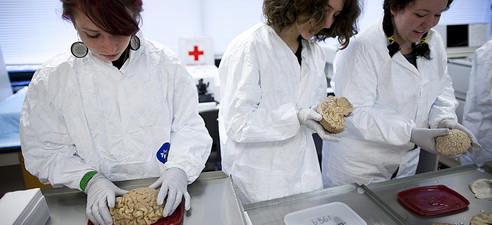 Le Harvard Brain Tissue Resource Center