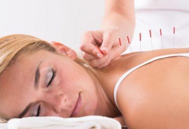 acupuncture-stress-patricia-lepertel